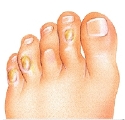 foot bone disorders podiatry clinic